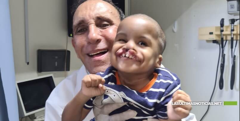Fundación Cruz Jiminián ha operado 6,500 infantes con labio leporino y paladar hendido
